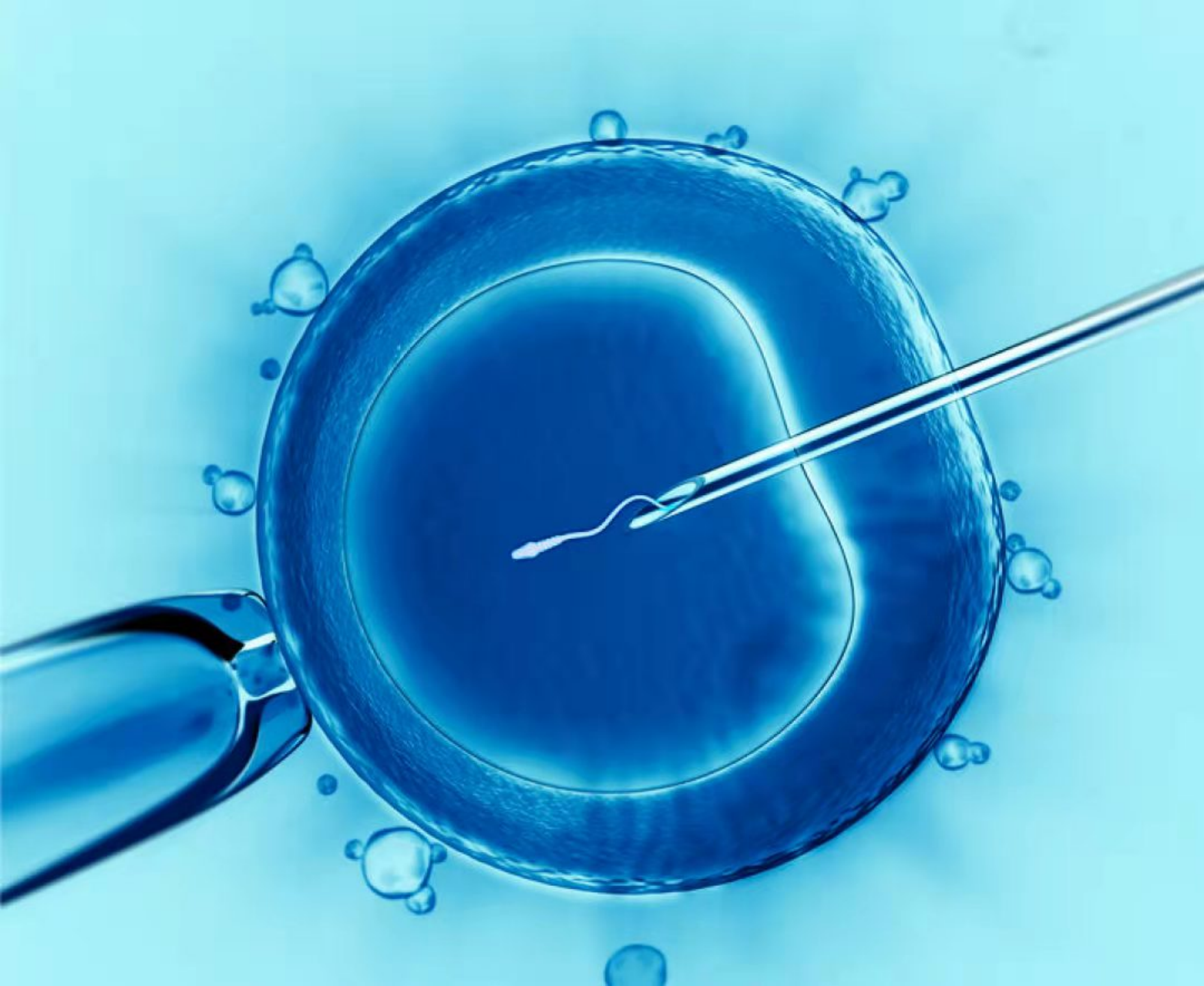 成都市试管婴儿技术应用现状分析