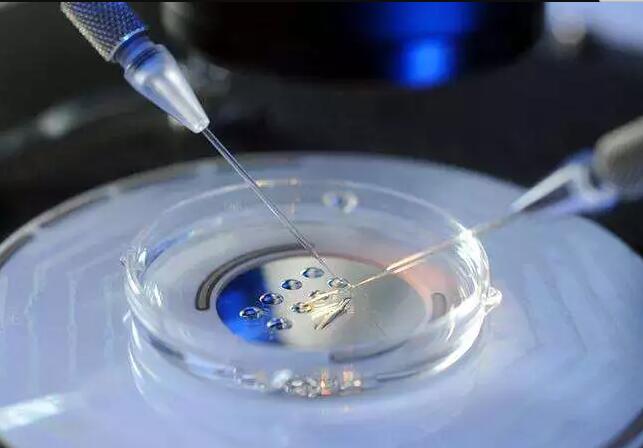 捐卵费用构成要素解析