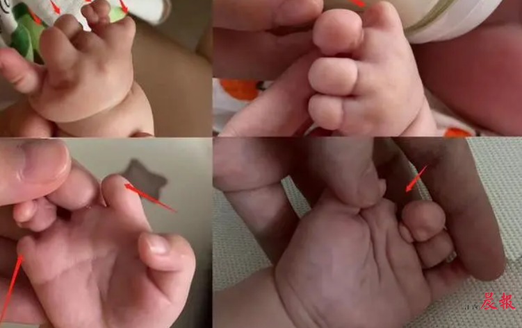 拉萨辅助生殖技术