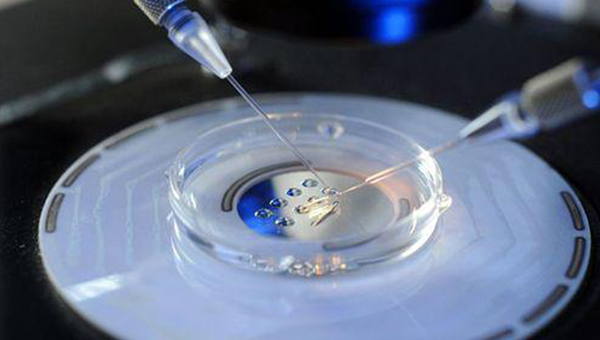 成都医院不孕不育诊疗技术